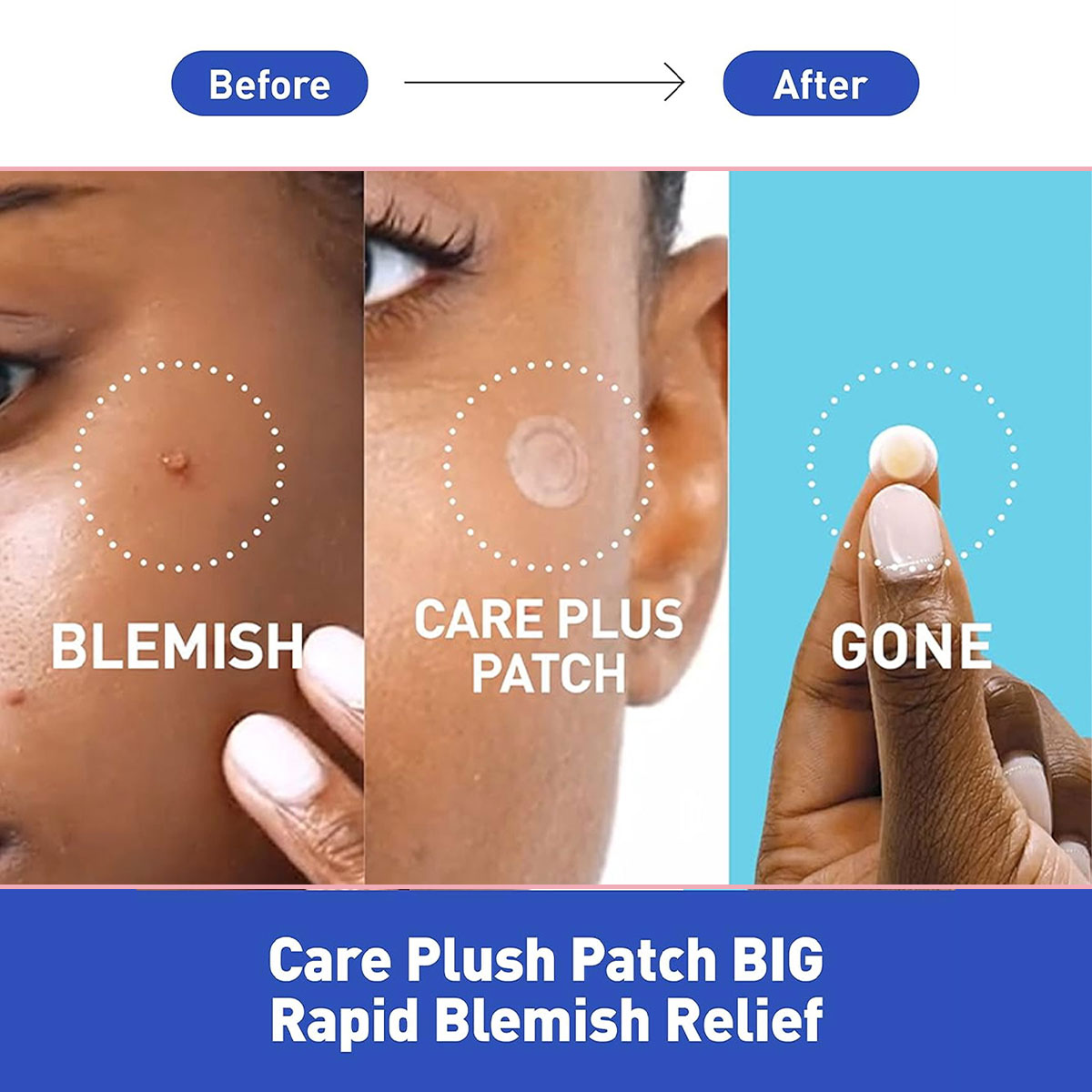 Olive Young Care Plus Spot Cov - Korean Lifestyle avaliação e preço